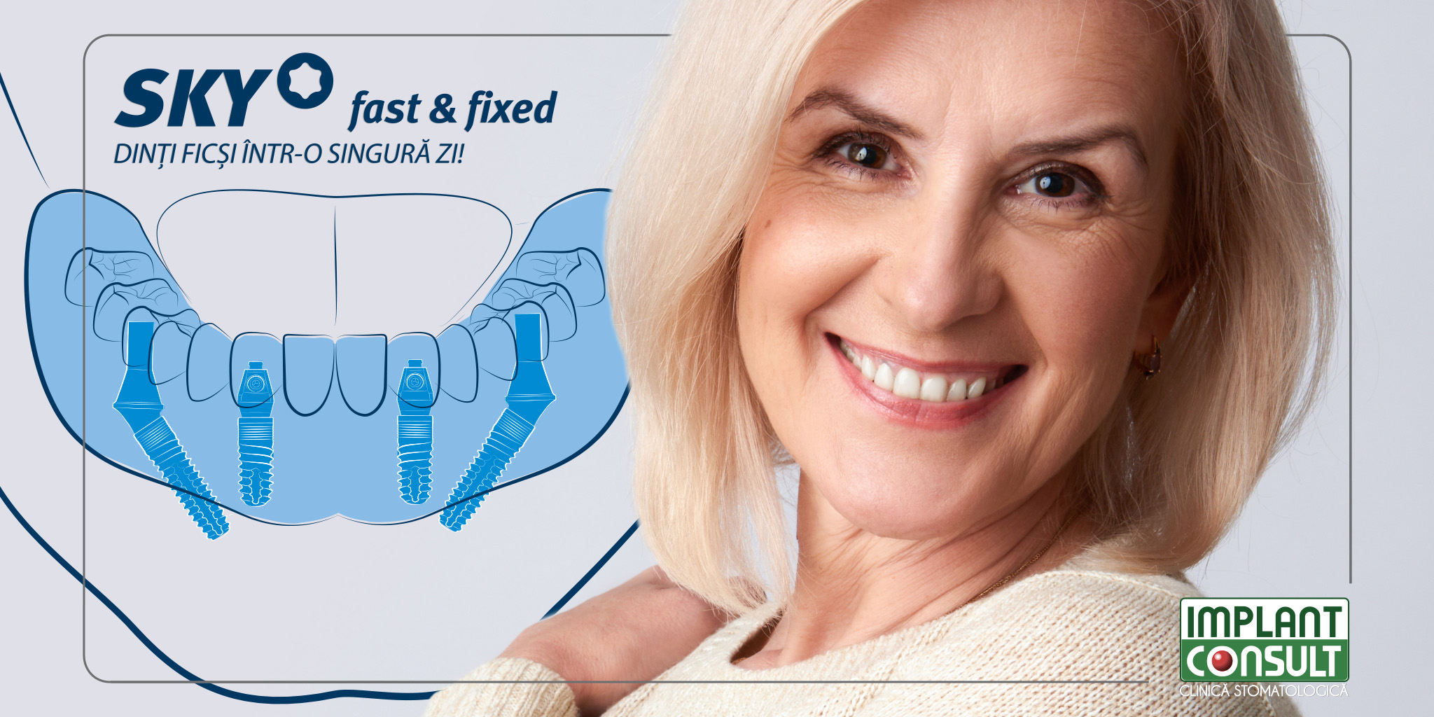 De ce dinti ficsi in locul protezei dentare mobile? SKY fast & fixed - Un concept terapeutic revolutionar. Dinti intr-o zi la Implant Consult